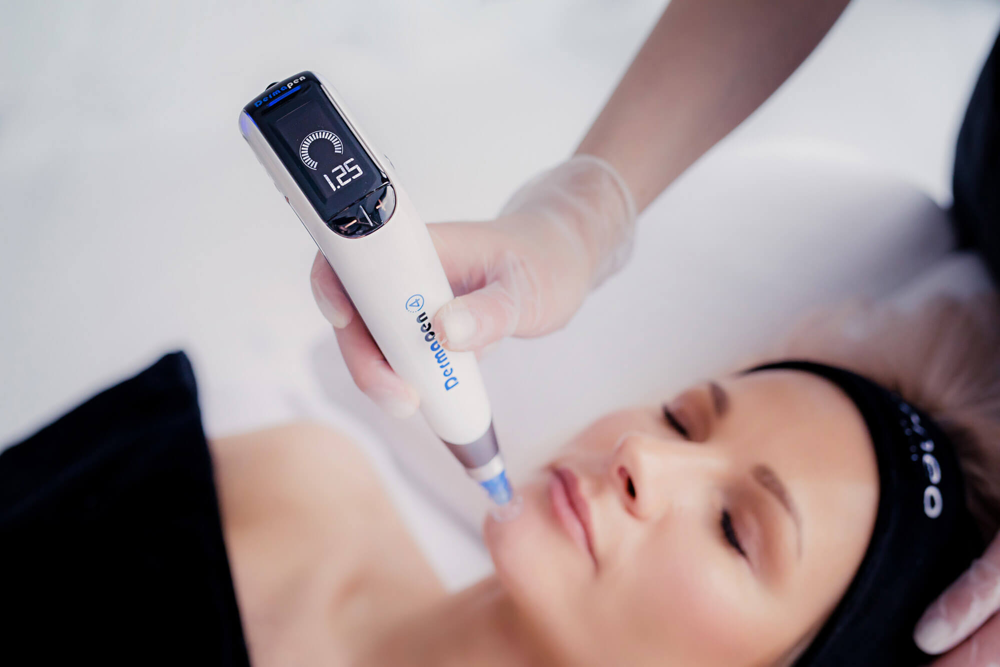 Dermapen: Co to jest i jak często go stosować?